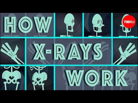 How X-rays see through your skin ?