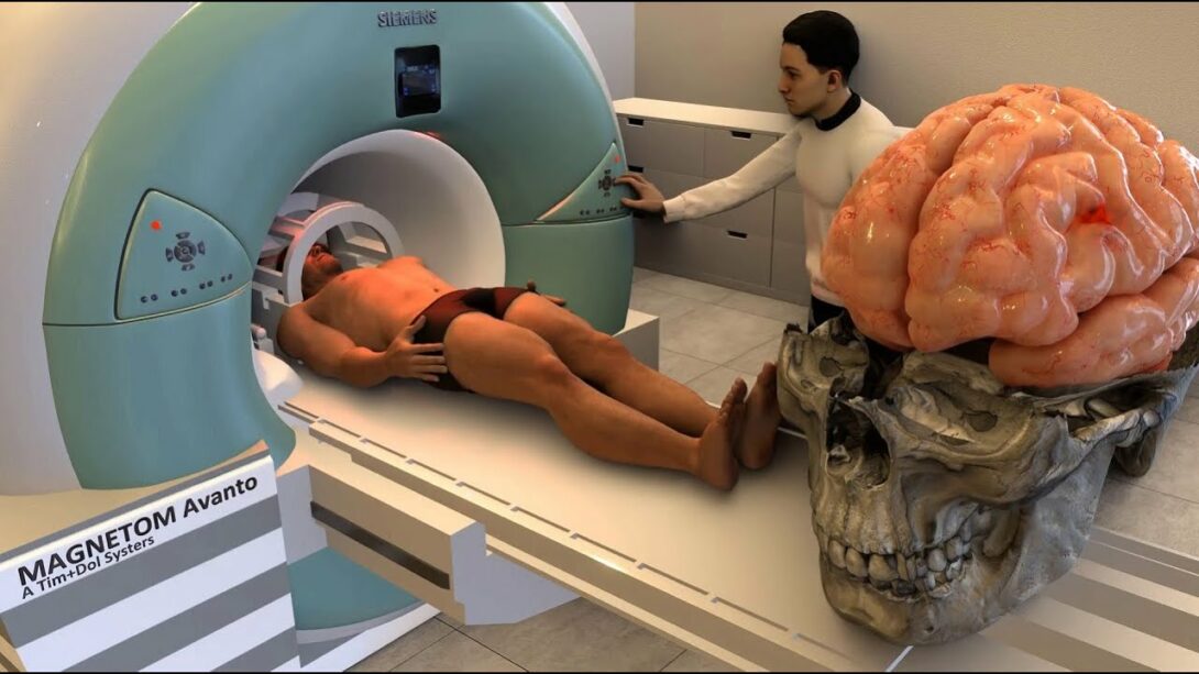 How does an MRI machine work? Magic of Science