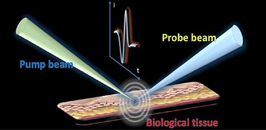 Lipid Imaging Using Photoacoustic Remote Sensing Microscopy