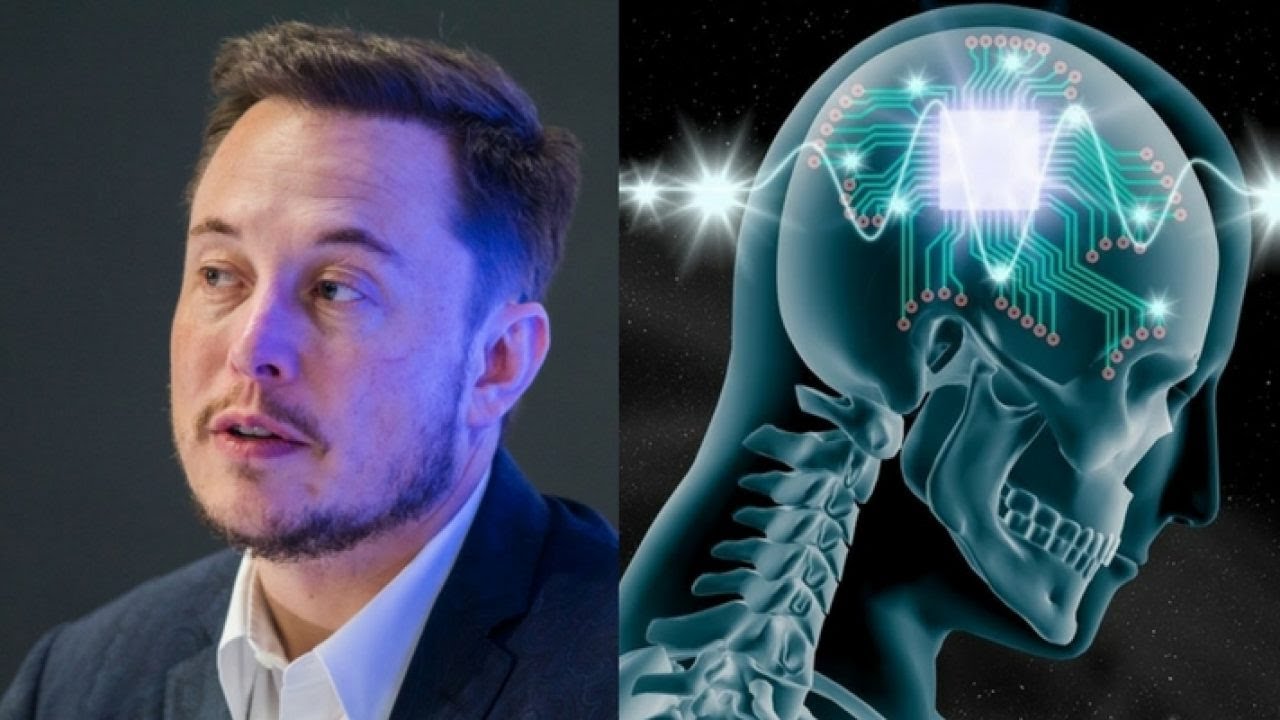 Elon Musk’s First Neuralink Wireless Brain Chip Human Implant!